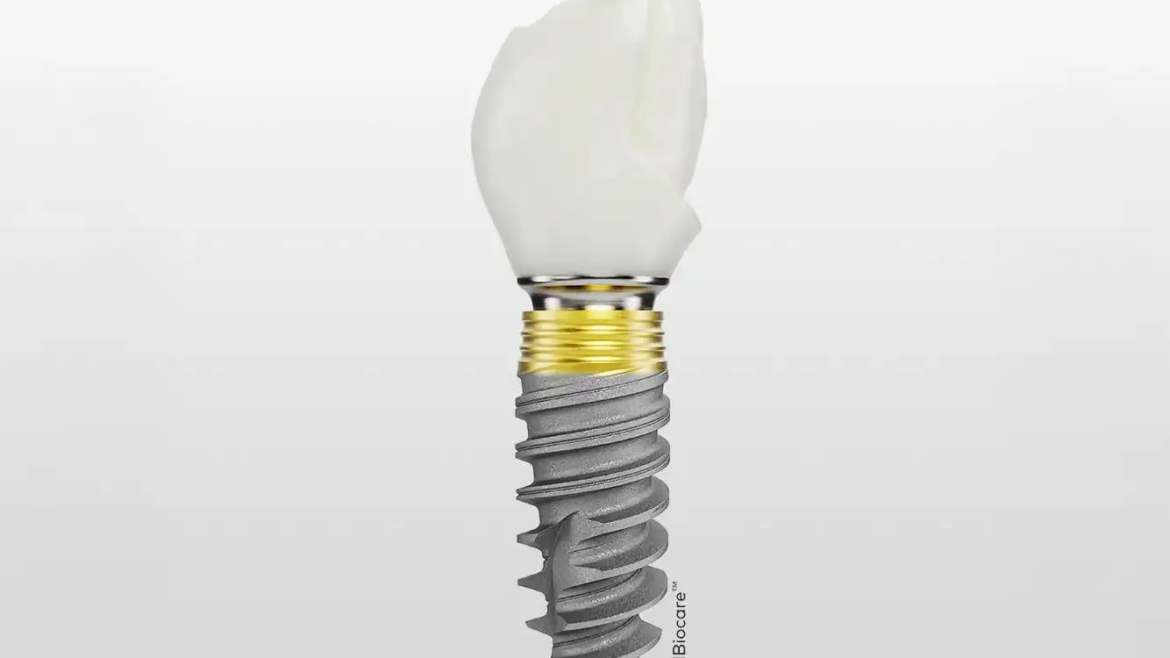 Nobel Biocare implantati