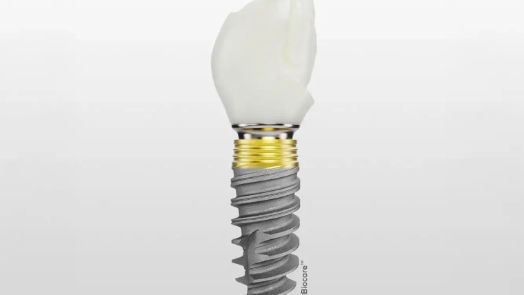 Nobel Biocare implantati